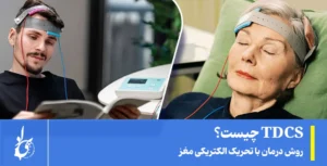 تحریک الکتریکی مغز tdcs