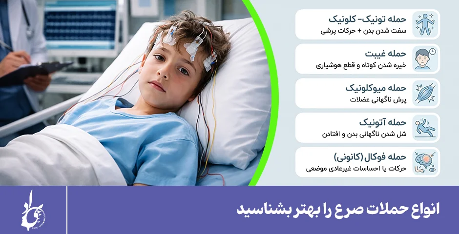 انواع حملات صرع را بشناسید