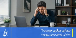 میگرن